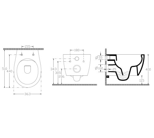 Чаша подвесного унитаза Allen Brau Fantasy 4.11004.SM розовый
